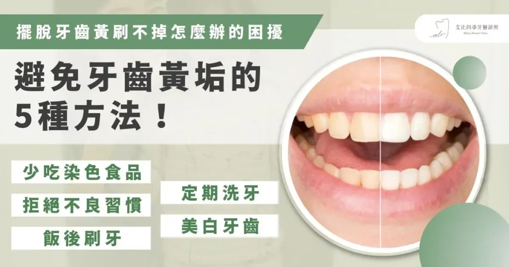 擺脫牙齒黃刷不掉怎麼辦的困擾，避免牙齒黃垢的 5 種方法！