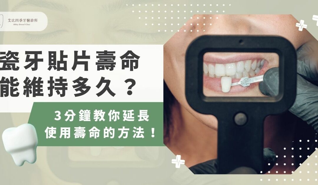 瓷牙貼片壽命能維持多久？ 3 分鐘教你延長使用壽命的方法！